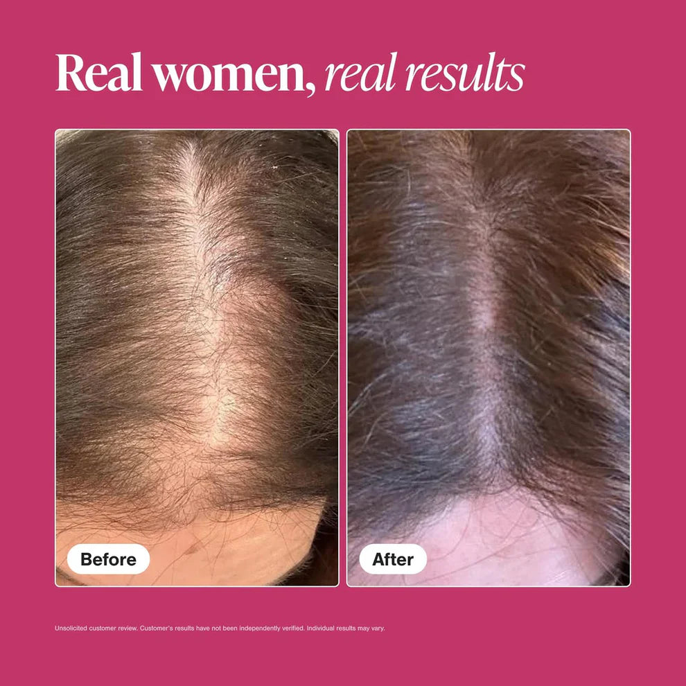 Viviscal Hair Growth Supplements for Women – Biotin & Marine Collagen, 180 Tablets (90-Day Supply)